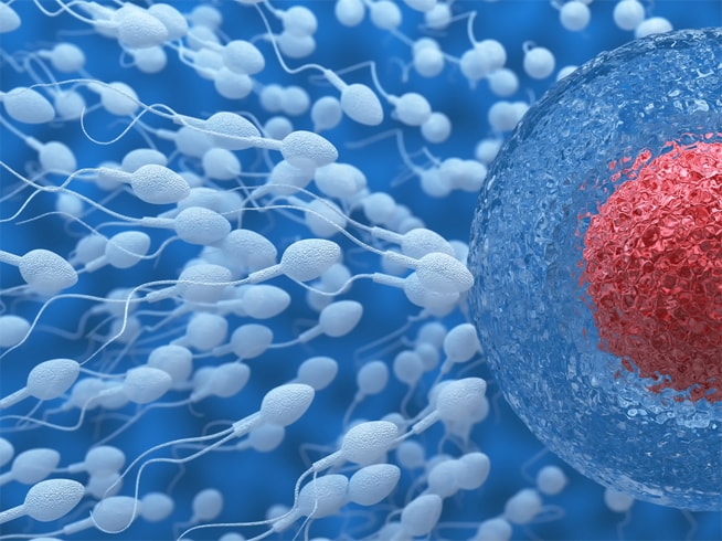 Male Infertility